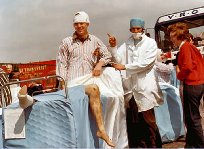 One of the imitation legs in bed